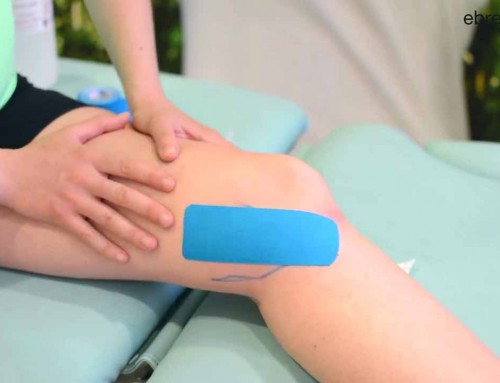 Vendaje neuromuscular para la pata de ganso